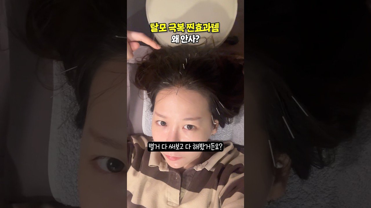 쿠팡에서 이건 꼭 사세요!! 탈모 극복 찐후기 추천템