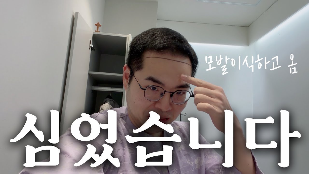 만 40살 테크 유튜버의 내돈내산 모발이식 후기